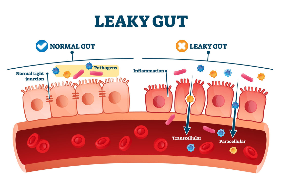 Metabolism Slowdown After 30? Why Your Gut Microbiome Holds the Key